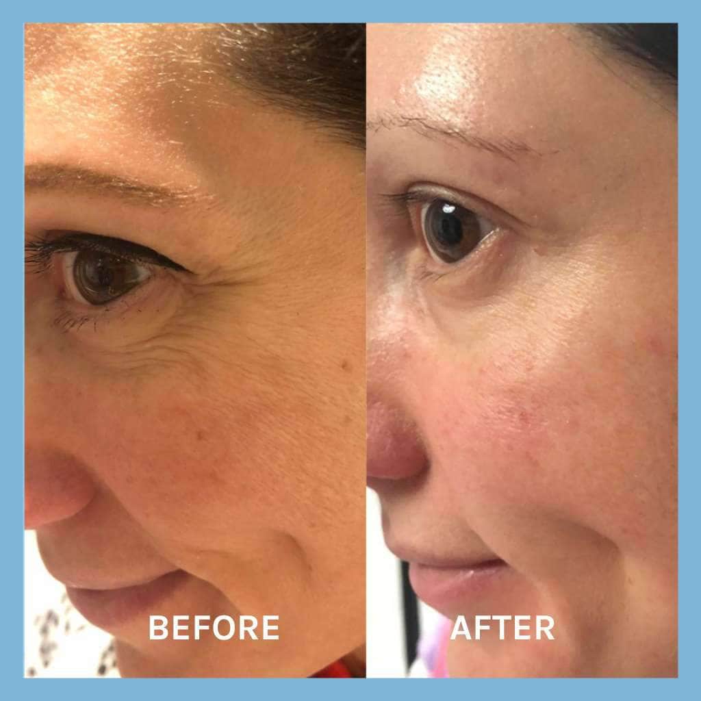 Evolve Organic Beauty Face Serum Age Defying Lifting Serum