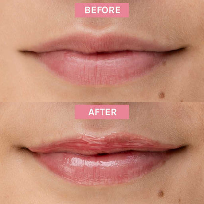 Before and afters of Bio-Retinol Glossy Lip oil on Fair Skin